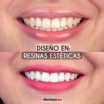 Slider image (3) Odontologia Laser